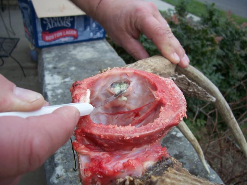 Skull-hole